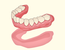 ハイドロキャスト法精密入れ歯