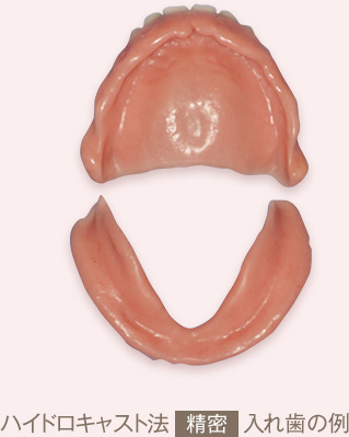 ハイドロキャスト法精密入れ歯の例
